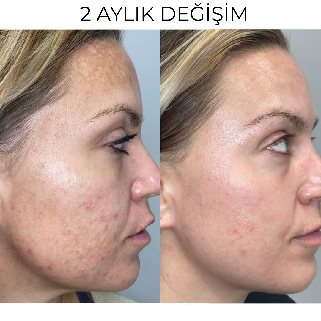 Liarina® Kuyruk Yağı & Bal Özü Krem